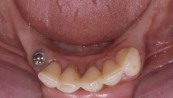 Pennwell web 250 142