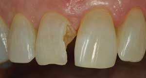 Pennwell web 300 160