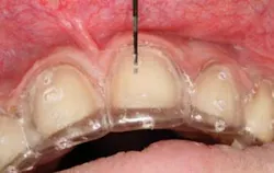 Pennwell web 300 190 Pennwell web 300 190