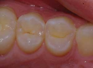 Pennwell web 300 220