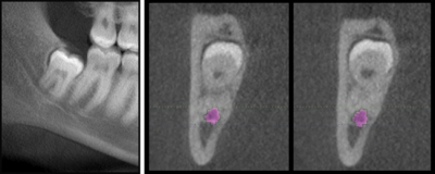 Pennwell web 400 160