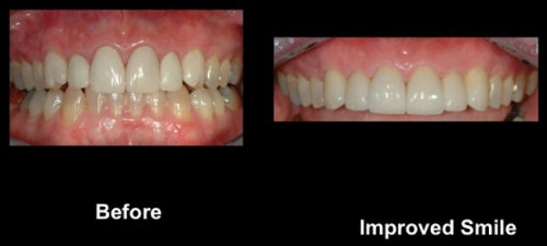 Pennwell web 500 225