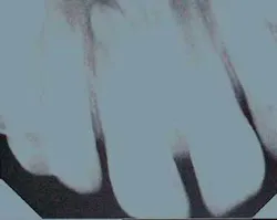 Th 0611demar01 Th 0611demar01