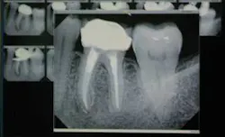 Th 0611demar03 Th 0611demar03