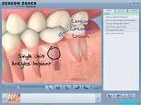 Th 0612detopten04 Th 0612detopten04