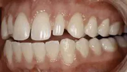 Th 0709deaac01 Th 0709deaac01