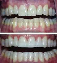Th 289845 Th 289845