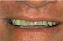 Th 9101depos01 Th 9101depos01