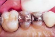 Th 9103deda3 Th 9103deda3