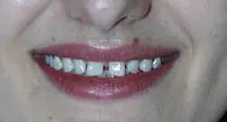 Th De109844 14 Th De109844 14