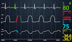 Vitalsigns Vitalsigns