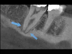 1603dechr P04 1603dechr P04