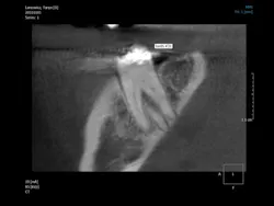 1603dechr P06 1603dechr P06