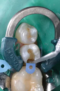 1609degoo P03 1609degoo P03