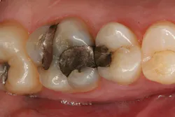 1609dehal P03 1609dehal P03