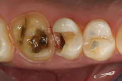 1609dehal P05 1609dehal P05