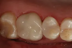 1609dehal P09 1609dehal P09