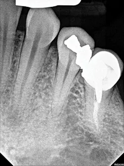 1701decaz P06 1701decaz P06