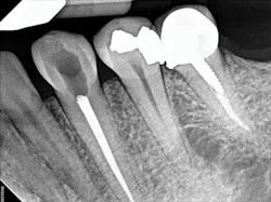 1701decaz P07 1701decaz P07