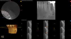 1701decaz P08 1701decaz P08