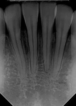 1701depea1 P03 1701depea1 P03