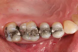 Ivoclar 1606deses P01 scale large png Ivoclar 1606deses P01 scale large png