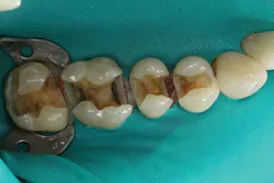 Ivoclar 1606deses P02 scale large png Ivoclar 1606deses P02 scale large png