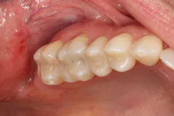 Ivoclar 1606deses P05 scale large png Ivoclar 1606deses P05 scale large png