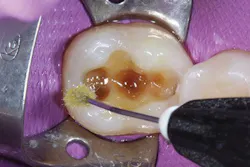 Ivoclar June Art3 Fig3 Ivoclar June Art3 Fig3