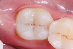 Ivoclar June Art3 Fig6 Ivoclar June Art3 Fig6