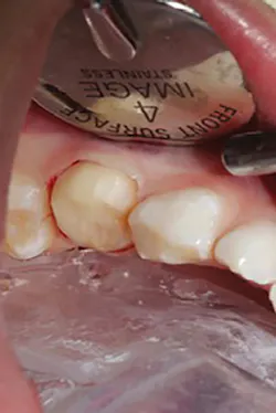 1709decoh P02 1709decoh P02