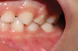 1709decoh P05 1709decoh P05