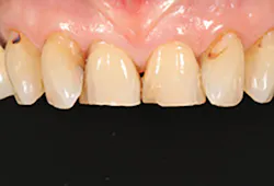 1709defer P01 1709defer P01