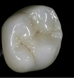 1709dehoo P01 1709dehoo P01