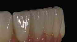 1709dehoo P07 1709dehoo P07