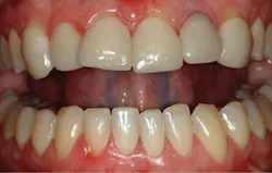 1709denas P01 1709denas P01