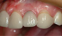 1709denas P03 1709denas P03