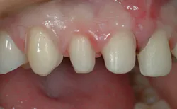 1709denas P06 1709denas P06