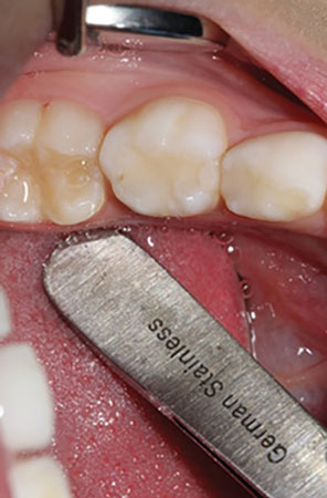 Content Dam De Print Articles Volume 107 Issue 9 1709decoh P01