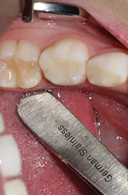 Content Dam De Print Articles Volume 107 Issue 9 1709decoh P01 Content Dam De Print Articles Volume 107 Issue 9 1709decoh P01