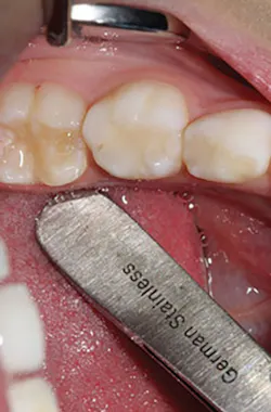 Content Dam De Print Articles Volume 107 Issue 9 1709decoh P01 Content Dam De Print Articles Volume 107 Issue 9 1709decoh P01