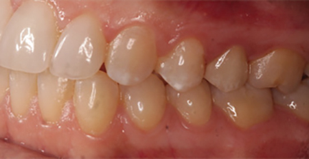 Content Dam De Print Articles Volume 107 Issue 9 1709degan P03