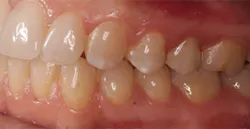 Content Dam De Print Articles Volume 107 Issue 9 1709degan P03 Content Dam De Print Articles Volume 107 Issue 9 1709degan P03