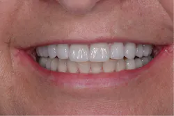 1710depec P08 1710depec P08