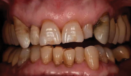 Content Dam De Print Articles Volume 107 Issue 10 1710decon P02