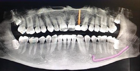 Content Dam De Print Articles Volume 107 Issue 10 1710dekop P01