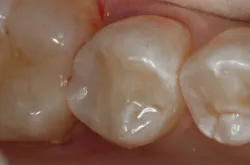 1711deshu P04 1711deshu P04