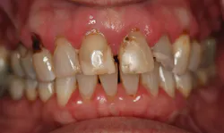 1711deshu P05 1711deshu P05