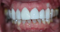 1711deshu P07 1711deshu P07