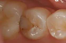 Content Dam De Print Articles Volume 107 Issue 11 1711deshu P01 Content Dam De Print Articles Volume 107 Issue 11 1711deshu P01